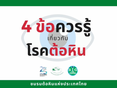 4 ข้อควรรู้เกี่ยวกับโรคต้อหิน